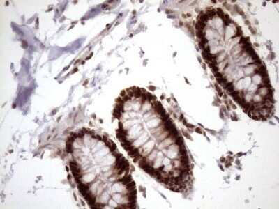 Immunohistochemistry: KLF9 Antibody (OTI8A11) - Azide and BSA Free [NBP2-70285]