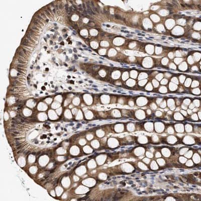 Immunohistochemistry-Paraffin: KLHDC1 Antibody [NBP1-82616]