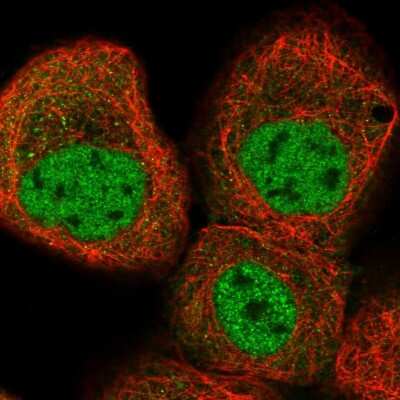 Immunocytochemistry/ Immunofluorescence: KLHDC10 Antibody [NBP1-81528]