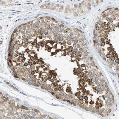 Immunohistochemistry-Paraffin: KLHDC10 Antibody [NBP1-81528]