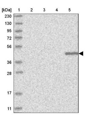 Western Blot: KLHDC3 Antibody [NBP1-85195]