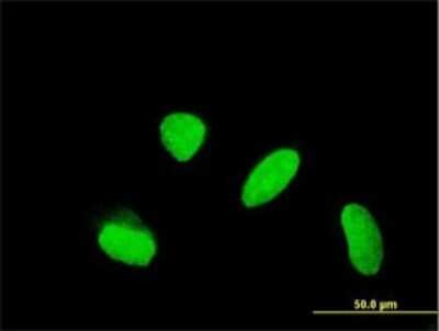 Immunocytochemistry/ Immunofluorescence: KLHDC4 Antibody (4G11) [H00054758-M02]