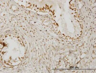 Immunohistochemistry-Paraffin: KLHDC4 Antibody (4G11) [H00054758-M02]