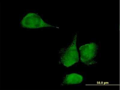 Immunocytochemistry/ Immunofluorescence: KLHDC4 Antibody [H00054758-B01P]