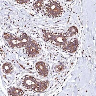 Immunohistochemistry-Paraffin: KLHDC4 Antibody [NBP1-85129]