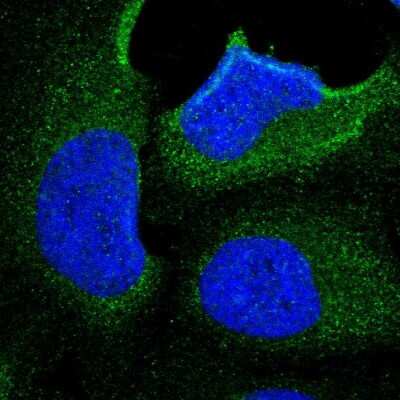 Immunocytochemistry/ Immunofluorescence: KLHDC8B Antibody [NBP1-82703]