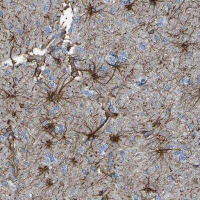 Immunohistochemistry-Paraffin: KLHDC8B Antibody [NBP1-82703]