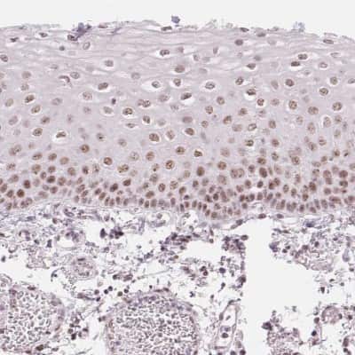 Immunohistochemistry: KLHDC9 Antibody [NBP2-48547]