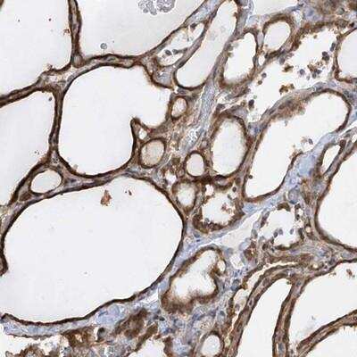 Immunohistochemistry-Paraffin: KLHDC9 Antibody [NBP1-83068]