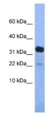 Western Blot: KLHDC9 Antibody [NBP1-79471]