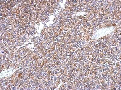 Immunohistochemistry-Paraffin: KLHL1 Antibody [NBP2-17076]