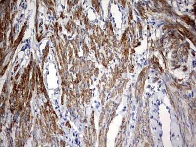 Immunohistochemistry: KLHL12/C3IP1 Antibody (OTI4E1) [NBP2-45512]