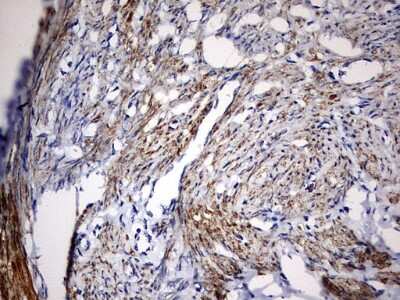 Immunohistochemistry: KLHL12/C3IP1 Antibody (OTI4E1) [NBP2-45512]