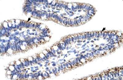 Immunohistochemistry-Paraffin: KLHL13 Antibody [NBP1-80047]