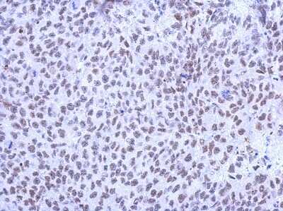 Immunohistochemistry-Paraffin: KLHL13 Antibody [NBP2-17079]