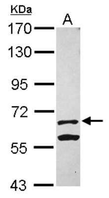 Western Blot: KLHL13 Antibody [NBP2-17079]