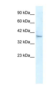 Western Blot: KLHL14 Antibody [NBP1-80048]