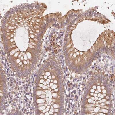 Immunohistochemistry: KLHL15 Antibody [NBP2-38077]