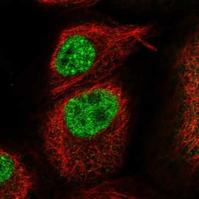 Immunocytochemistry/ Immunofluorescence: KLHL17 Antibody [NBP1-85926]