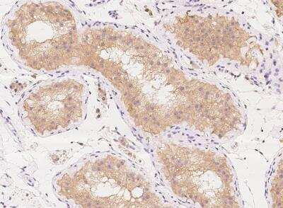 Immunohistochemistry-Paraffin: KLHL17 Antibody [NBP3-06047]