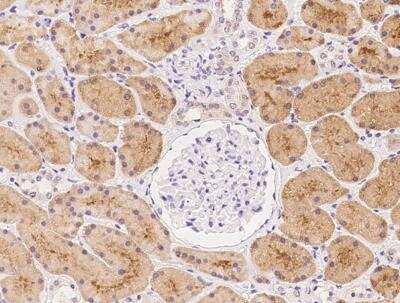 Immunohistochemistry-Paraffin: KLHL17 Antibody [NBP3-06047]