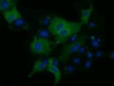 Immunocytochemistry/ Immunofluorescence: KLHL2 Antibody (OTI1G7) [NBP2-02939]