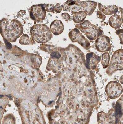 Immunohistochemistry-Paraffin: KLHL20 Antibody [NBP1-81559]