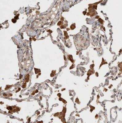 Immunohistochemistry-Paraffin: KLHL20 Antibody [NBP1-81559]
