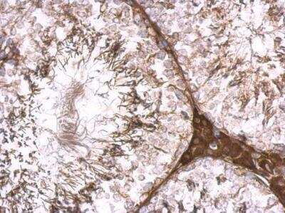 Immunohistochemistry-Paraffin: KLHL25 Antibody [NBP2-17082]