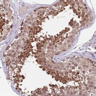 Immunohistochemistry-Paraffin: KLHL29 Antibody [NBP2-14167]