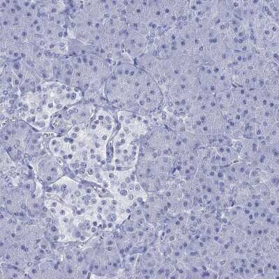 Immunohistochemistry-Paraffin: KLHL33 Antibody [NBP3-17104]