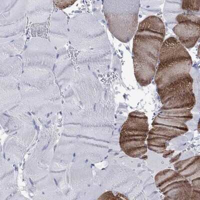 Immunohistochemistry-Paraffin: KLHL33 Antibody [NBP3-17104]