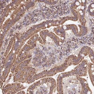 Immunohistochemistry: KLHL34 Antibody [NBP2-32524]