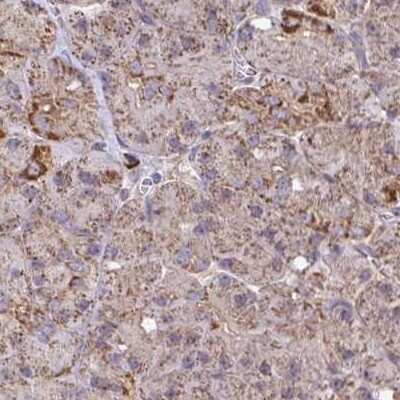Immunohistochemistry: KLHL34 Antibody [NBP2-32524]