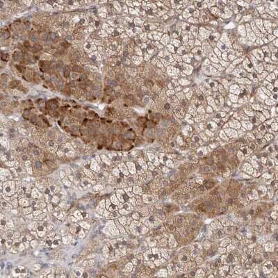 Immunohistochemistry-Paraffin: KLHL4 Antibody [NBP1-84210]