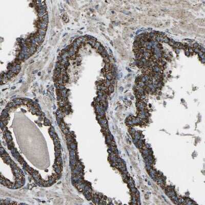 Immunohistochemistry-Paraffin: KLHL5 Antibody [NBP1-91102]