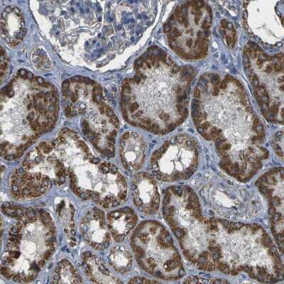 Immunohistochemistry-Paraffin: KLHL5 Antibody [NBP1-91102]