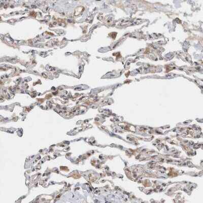Immunohistochemistry-Paraffin: KLHL6 Antibody [NBP1-83880]