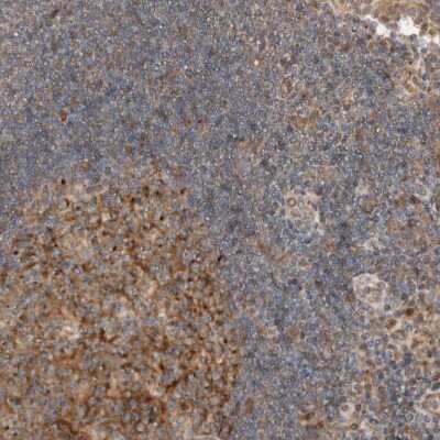 Immunohistochemistry-Paraffin: KLHL6 Antibody [NBP1-83880]