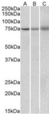 Western Blot: KLHL6 Antibody [NBP1-46128]