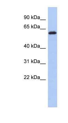 Western Blot: KLHL7 Antibody [NBP1-55462]