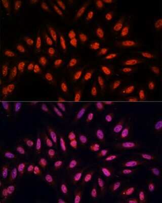 Immunocytochemistry/ Immunofluorescence: KLHL8 Antibody - Azide and BSA Free [NBP3-04914]