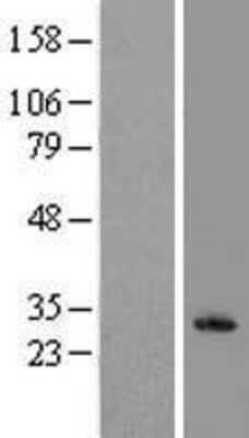 Western Blot: NKp80/KLRF1 Overexpression Lysate [NBL1-12366]