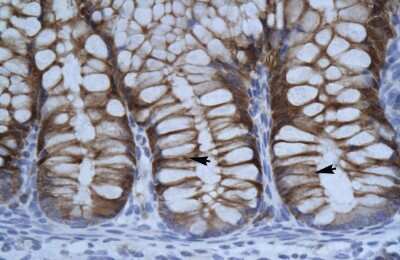 Immunohistochemistry: KMT1A/SUV39H1 Antibody [NBP2-82268]