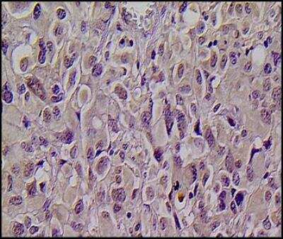 Immunohistochemistry-Paraffin: KMT1A/SUV39H1 Antibody [NBP1-21367]