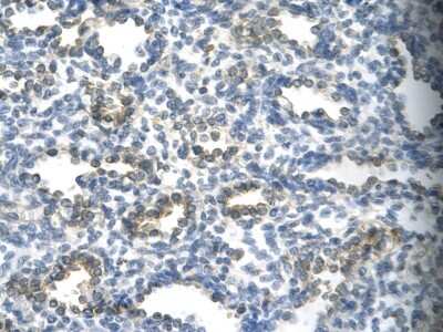 Immunohistochemistry-Paraffin: KMT1A/SUV39H1 Antibody [NBP2-82268]