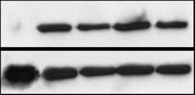 Western Blot: KMT1A/SUV39H1 Antibody [NBP1-21367]