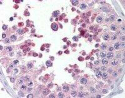 Immunohistochemistry-Paraffin: KMT2B Antibody [NB300-864]