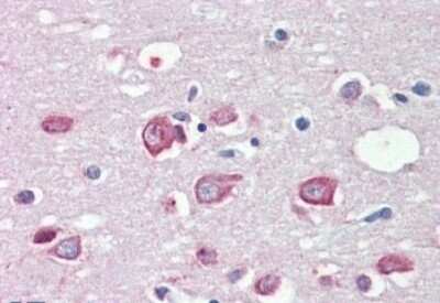 Immunohistochemistry-Paraffin: KMT2B Antibody [NB300-864]