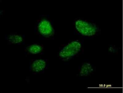 Immunocytochemistry/ Immunofluorescence: KNL-2 Antibody [H00055320-B01P]